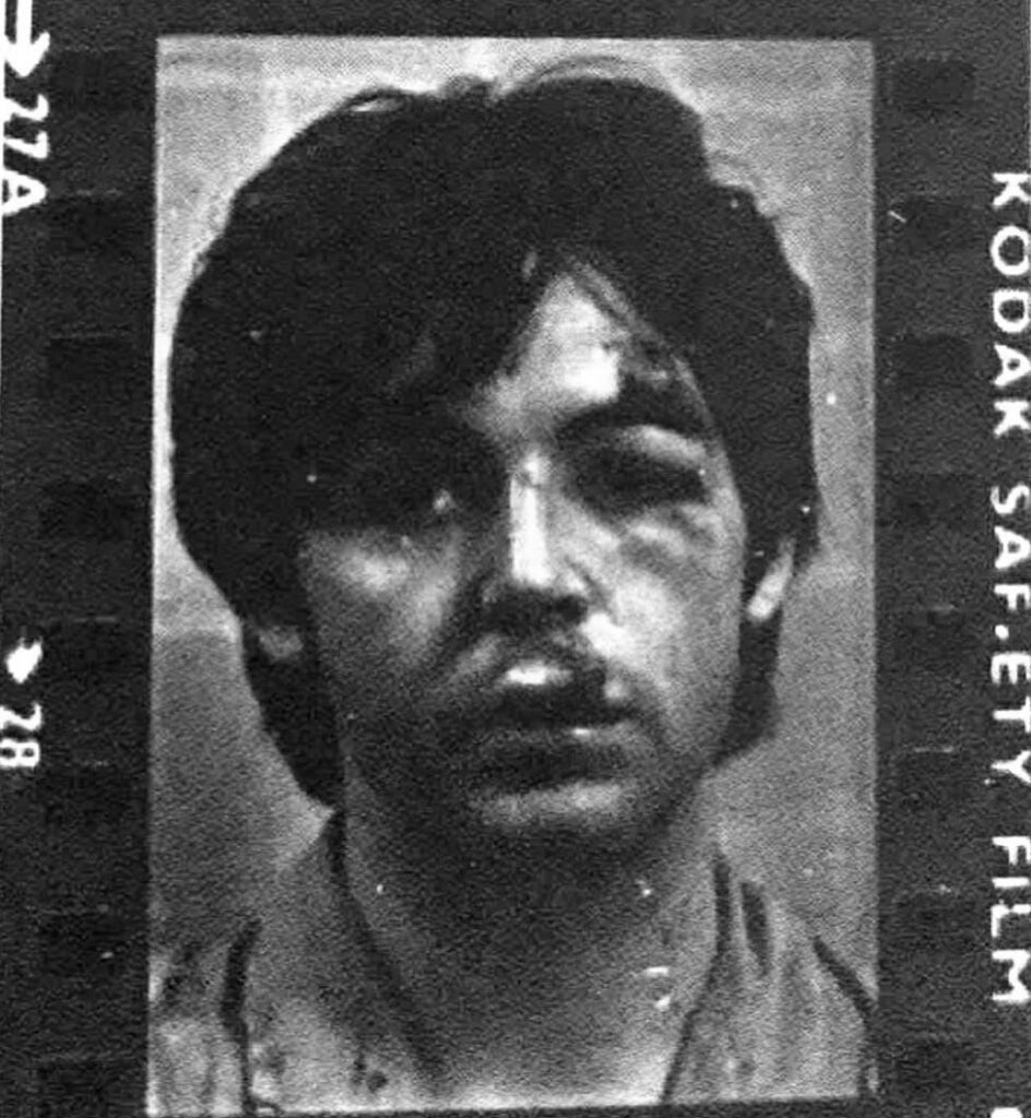 事故後のPaul McCartneyの写真